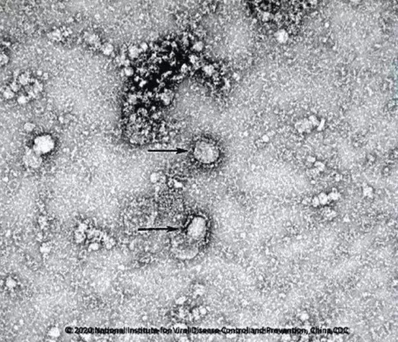 ▲新型冠狀病毒武漢株01。照片來源：國家病原微生物資源庫（中國疾病預(yù)防控制中心病毒病預(yù)防控制所）